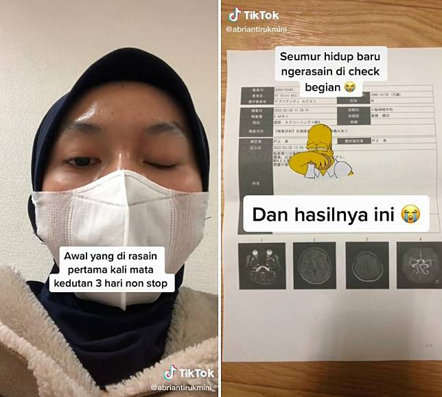 Mata Kedutan 3 Hari Nonstop dan Mulut Meleyot