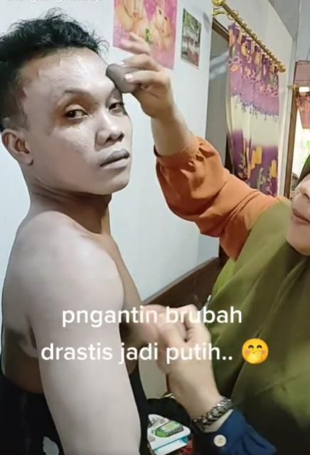 Pengantin Pria Jalani Pemutihan Kulit Dadakan