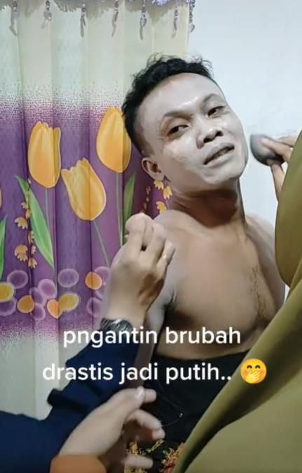 Pengantin Pria Jalani Pemutihan Kulit Dadakan